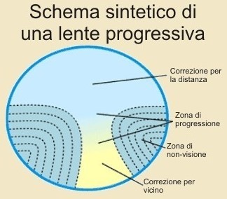 Vendita lenti progressive Milano